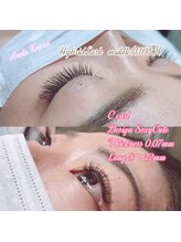 アネラカプア(Anela Kapua)/