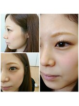 ルラン(luran)/ヘップバーンラッシュリフト☆