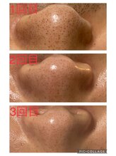 サムライの美/来店後の変化に驚かれる方多数★