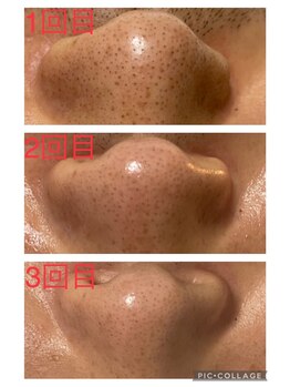 サムライの美/来店後の変化に驚かれる方多数★