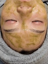 エピシア(EPISIA)