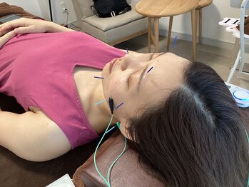 ハリファ鍼灸院 横浜関内院(HariFa鍼灸院)/美容施術/美容鍼