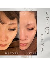 美バリ 新宿店(美BARI)/エアバリ　1回