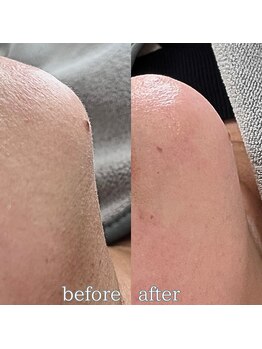 フットミー(foot mii)/フェイシャルワックス