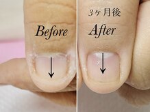 トゥインクリーネイルサロン(Twinkly Nail Salon)/【最強のネイルケア】1回お試し