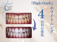 ラフ(LAUGH)/【審・美・白】 ホワイトニング