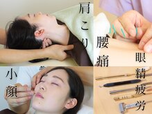 かつらはりきゅう 小児しん