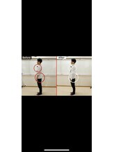 東洋カイロプラクティック麻布十番療術センター/姿勢改善による体の変化（側面）