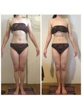 サロン ド ディジェール(Salon de Degel)/継続ケア6ヶ月/120分コース