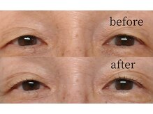 ジェリタ 立川北/まつげパーマで印象が変わる！