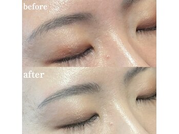 ブリリアント(brilliant)/ハリウッドブロウリフト