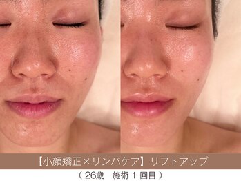 ホワイトカメリア(White Camellia)/オーダーメイドフェイシャル