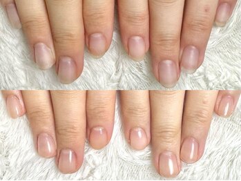 深爪矯正 爪悩み専門店 グラシナ 西宮北口店【4/3 NEW OPEN（予定）】/(深爪/長さだし/フィルイン)