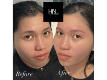 ジョエルワックス 沖縄那覇店(JOELLE WAX)/HBLで眉癖改善！！