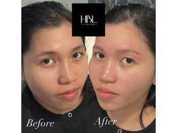 ジョエルワックス 沖縄那覇店(JOELLE WAX)/HBLで眉癖改善！！