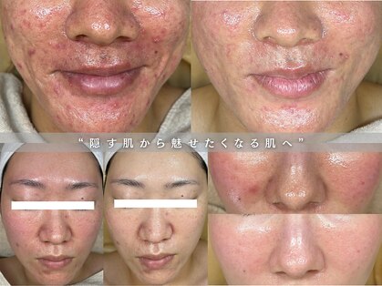 ウニカ(Unica)の写真