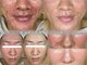 ウニカ(Unica)の写真