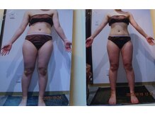 パーフェクトボディプレミアム 大阪梅田店(PERFECT BODY PREMIUM)/お客様　ビフォーアフター（18）