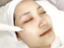 【gembyartefice】でもシミケア施術が可能になりました★