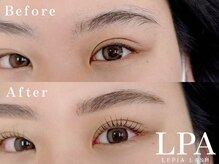 レピア 仙台店/韓国式LEPIA Before&Aｆter