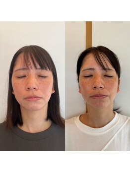 こうぞう整体院/美容鍼×筋膜リリース