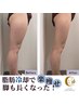 【脂肪冷却＆高濃度脂肪◯解剤＆ラジオ派】話題の脂肪冷却メガ盛り/4cup
