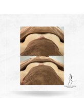 エレガンスアンドビューティー 船橋本店(Elegance&Beauty)/横流れにも効果あり！