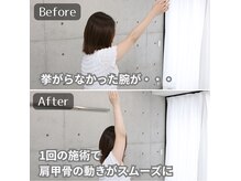 鍼灸整体院ユー(鍼灸整体院You...)の雰囲気（腸もみ/腸活/下痢/デトックス/オイルマッサージ/肩甲骨）