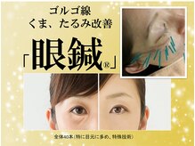 ハリス(HARIS)/目元のたるみ改善コース「眼鍼」