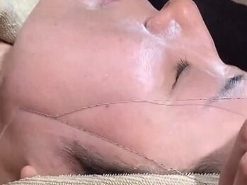 グラシエラ(Graciela)の写真/シルク糸を使用した《顔脱毛》でツルすべ肌に♪気になるお顔のうぶ毛もスッキリ除去していきます◎