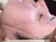 グラシエラ(Graciela)の写真/シルク糸を使用した《顔脱毛》でツルすべ肌に♪気になるお顔のうぶ毛もスッキリ除去していきます◎