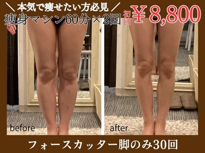 ジーニー(Genie)の写真