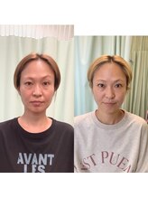 あらた鍼灸整骨院/美容鍼