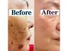 【たるみ×くすみWケア】年齢肌引き締め◎ 二重あご◎(60分)