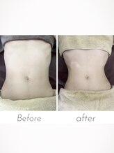 メリハリラボ(MeriHari.Lab)/【最強キャビ】ビフォーアフター