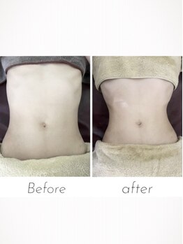 メリハリラボ(MeriHari.Lab)/【最強キャビ】ビフォーアフター