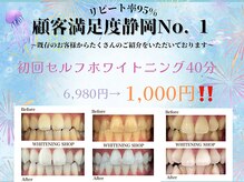 ホワイトニングショップ 葵区静岡駅店