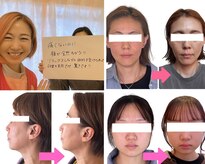 小顔矯正サロン ブルーム