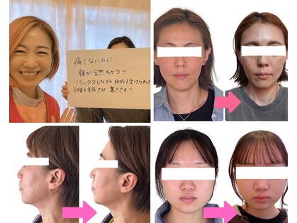 小顔矯正サロン ブルームの写真
