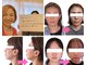 小顔矯正サロン ブルームの写真