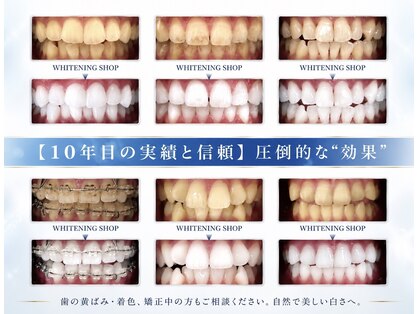 ホワイトニングショップ 長岡京店の写真