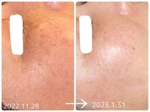 フォーチューン/ハーブトリートメント♪