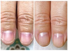 コティ(cotty)/自爪育成◎３か月後