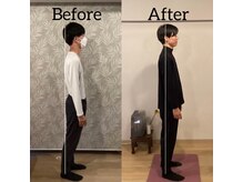 おこしんちゅ 渋谷 代々木公園/施術前後の写真です