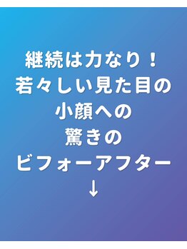ぐっすりん/一度で変化を実感→リピートへ◎