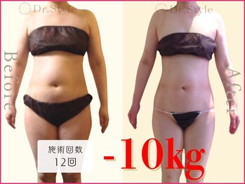 ココア整体 岐阜店(cocoa整体)/最新痩身マシン/脂肪燃焼リンパ