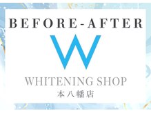 ホワイトニングショップ 本八幡店/症例数No. 1☆ホワイトニング
