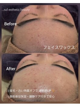 ルフ エステティック ビューティー(ruf esthetic beauty)/フェイスワックス