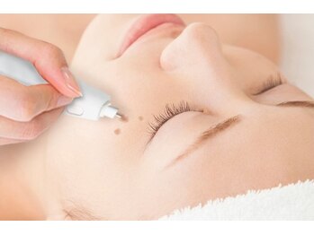 エンボーテ(enbeaute)の写真/【シミケア】季節の変わり目に、透明感のある肌印象へ。
肌をいたわりながら行う低周波シミケア