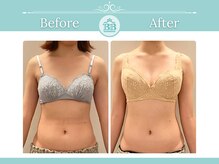 美人バスト 浜松店/◇ バストアップ &nbsp;BeforeAfter◇